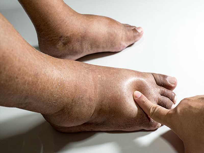 rehab-centres-in-chromepet